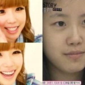 바퀴